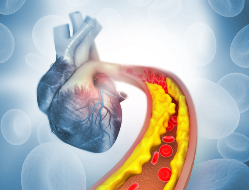 Terapie di spegnimento del gene del colesterolo alto: una nuova frontiera nella lotta contro le malattie cardiovascolari