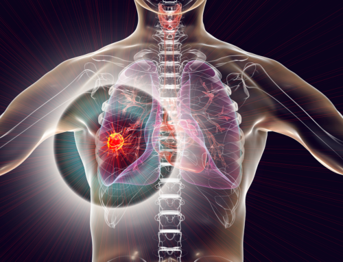 Unesbulin e il tumore al polmone: un nuovo approccio terapeutico