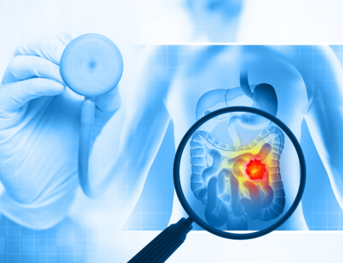 Tumore del colon-retto: diagnosi e rilevamento tramite analisi del sangue