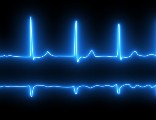 Le extrasistole: un fenomeno comune del battito cardiaco