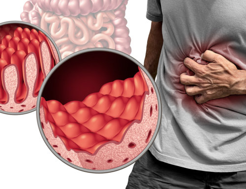 La celiachia e la reazione immunitaria al glutine